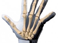 Manus Glove